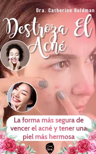 Destroza El Acné: La forma más segura de vencer el acné y tener una piel más hermosa(Kobo/電子書)